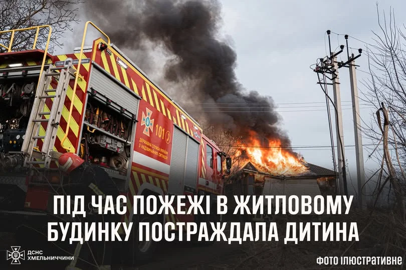 На Хмельниччині під час пожежі постраждала маленька дитина