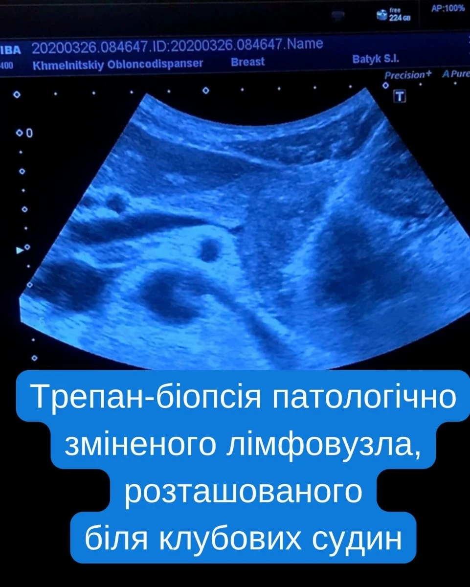 ВАКС можуть конфіскувати мільйони у посадовця міграційної служби з Хмельницької області