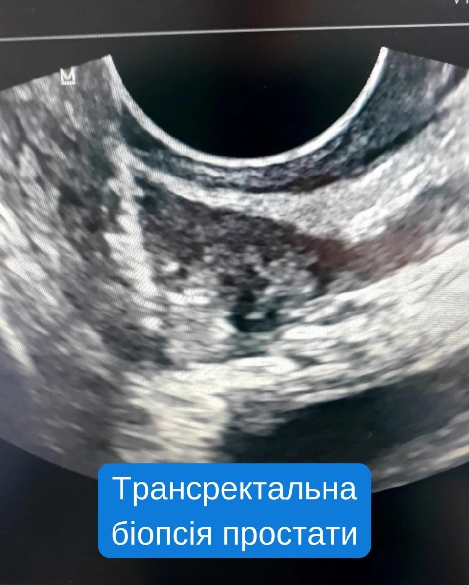 ВАКС можуть конфіскувати мільйони у посадовця міграційної служби з Хмельницької області