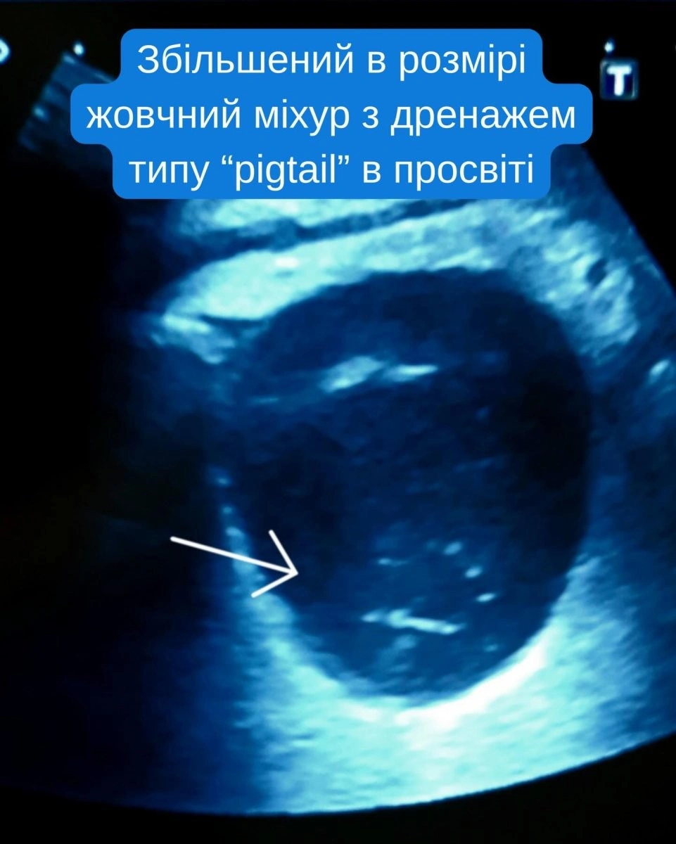 ВАКС можуть конфіскувати мільйони у посадовця міграційної служби з Хмельницької області
